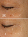 Retinol-Alternative Augenserum - 15 ml